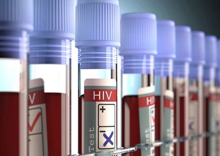 O exame de HIV pode ajudar a salvar vidas Laboratório CEDLAB
