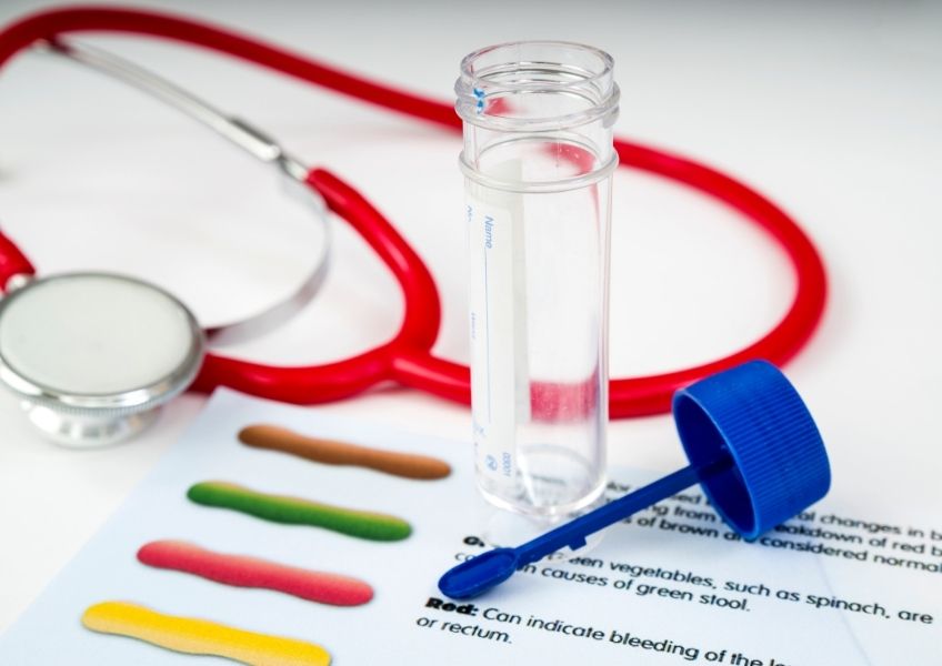 Conjunto de equipamentos médicos aparecem sobre uma mesa. Há umestetoscópio, um frasco para coleta de amostras obtidas para exames um uma folha com a legenda colorida referente a resultados de exames.