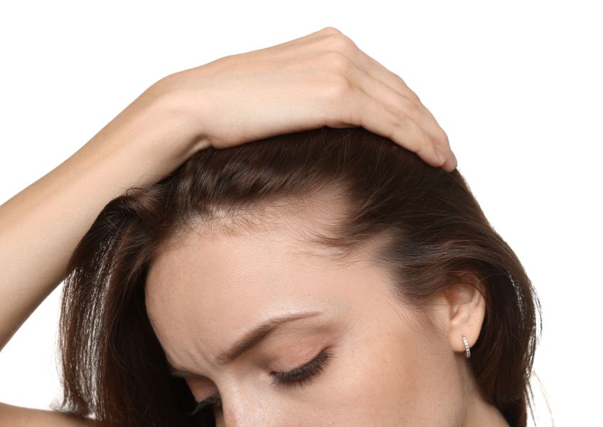 Mulher com problema de queda de cabelo