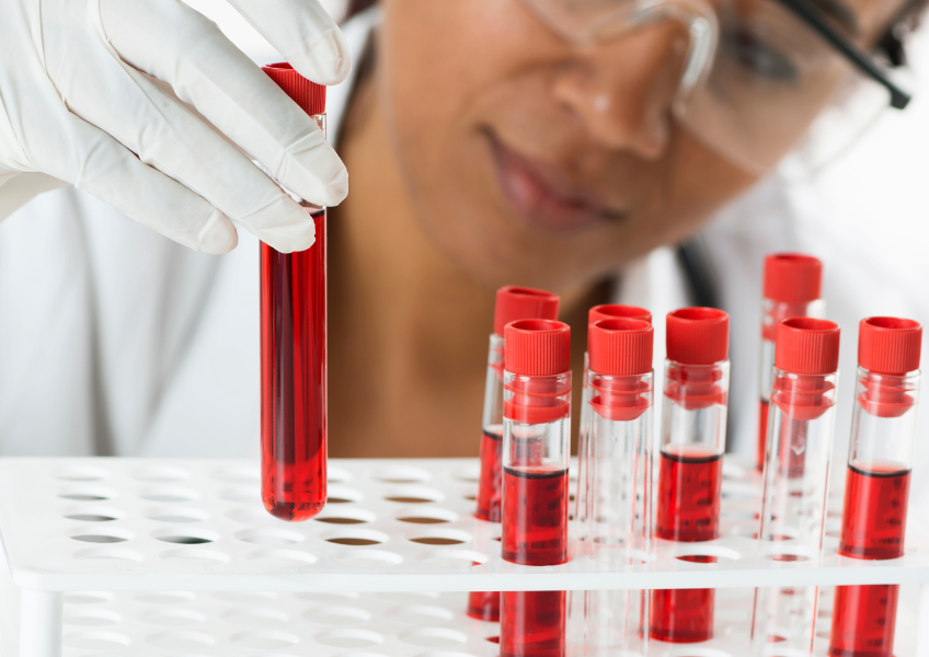 Técnica de laboratório organiza tubos de exames de sangue preventivos.